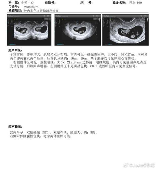 婴儿试管大约多少钱_做试管婴儿的全部费用大概是多少_婴儿试管一共需要多少钱