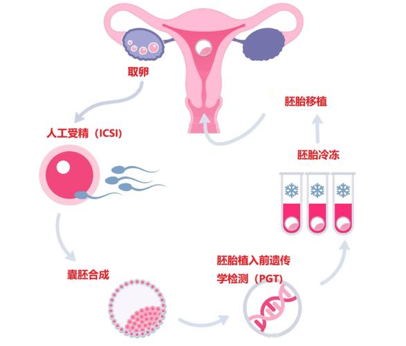 婴儿试管过程视频_试管婴儿的过程_婴儿试管过程图解