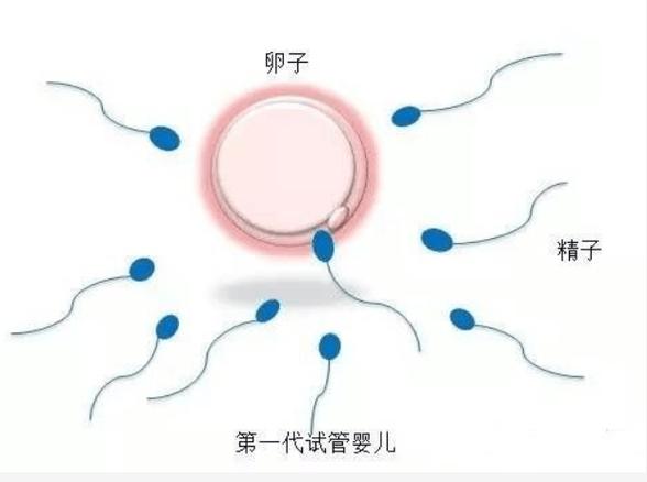 三代试管婴儿_试管婴儿代数_做婴儿试管