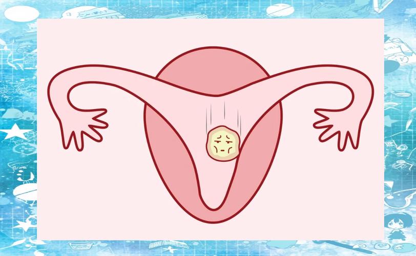 婴儿试管详细步骤_婴儿试管视频_试管婴儿
