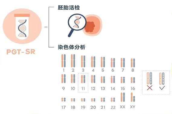 婴儿试管步骤_试管婴儿的具体流程_婴儿流程试管具体步骤