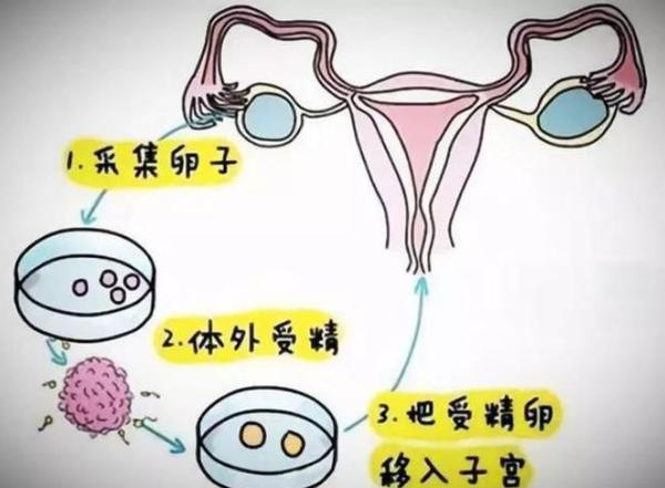 试管婴儿的全部流程_婴儿流程试管全部过程视频_婴儿试管步骤